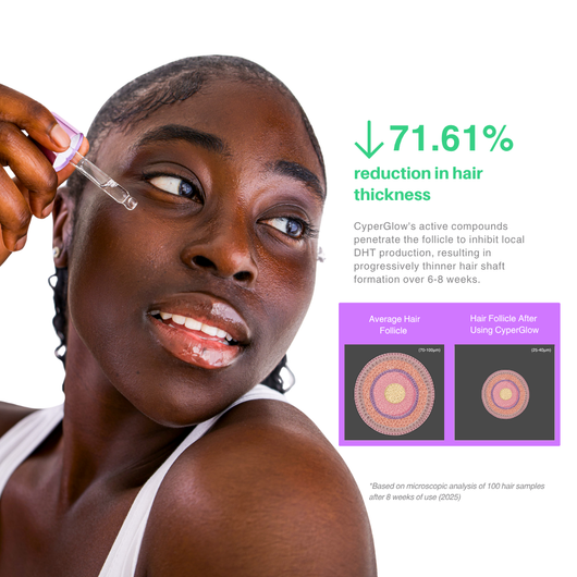 Sypelume™ - Sérum Anti-Repousse